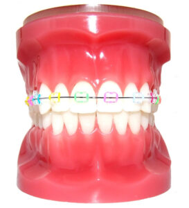 ortodoncja sopot