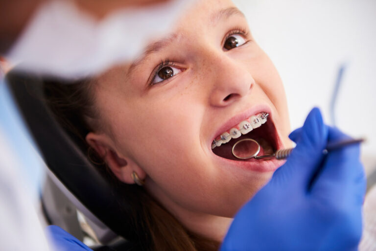Leczenie ortodontycznym aparatem stałym