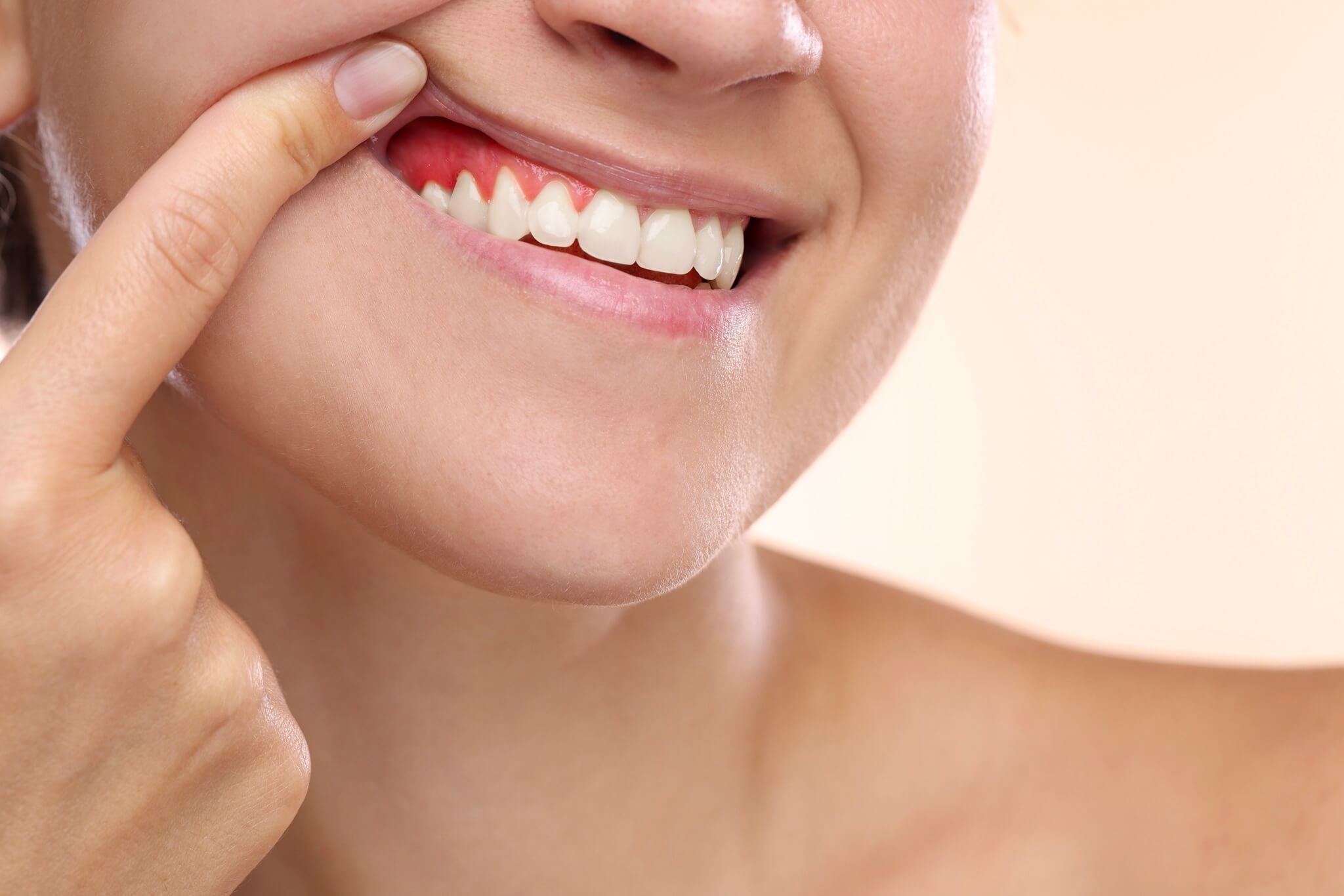 Krwawiące dziąsła – przyczyny, leczenie i kiedy zgłosić się do dentysty